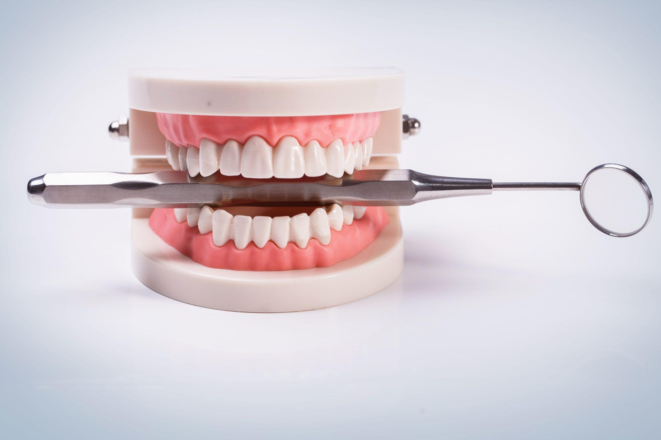 tratamiento maloclusion